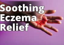The Healing Power Of Cbd Oil For Eczema: Unlocking Nature’S Solution For Healthy Skin